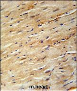 KIF24 Antibody (N-term)