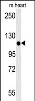 KIF24 Antibody (N-term)