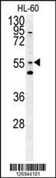 LMA1L Antibody (Center)