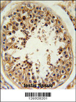 RSPO4 Antibody (C-term)