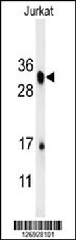 RSPO4 Antibody (C-term)