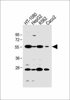 SLC10A1 Antibody (C-term)