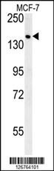 SAMD9 Antibody (C-term)
