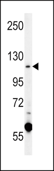 CACNA2D4 Antibody (N-term)