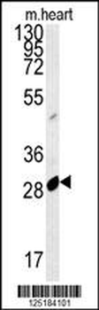 APOBEC2 Antibody (N-term)