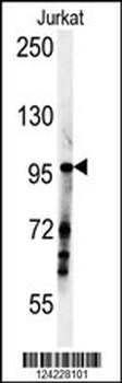 SPAG1 Antibody (N-term)