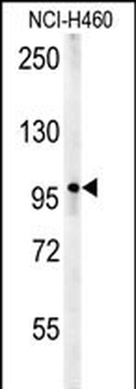 ZC3HAV1 Antibody (C-term)