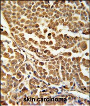 ZNF313 Antibody (C-term)