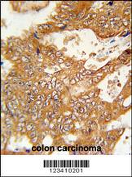 FBXO34 Antibody (C-term)
