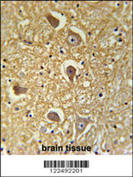 HAS2 Antibody (Center)
