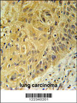WNT5A Antibody (Center)