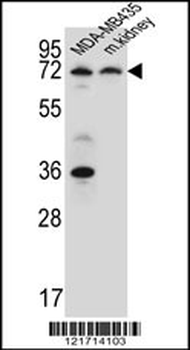 P2RX7 Antibody (C-term)