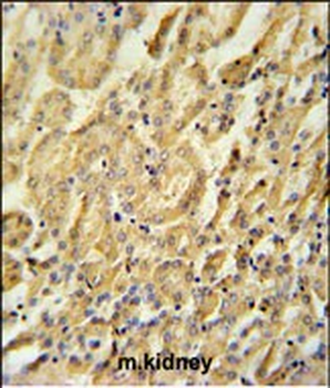 BTBD9 Antibody (Center)