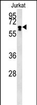 BTBD9 Antibody (Center)