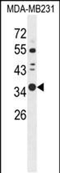 STX7 Antibody (N-term)