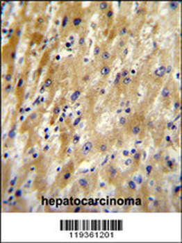 HABP2 Antibody (C-term)