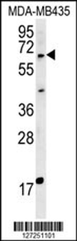 MKRN3 Antibody (Center)