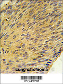 MURC Antibody (N-term)