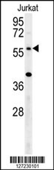 TRIM50 Antibody (C-term)