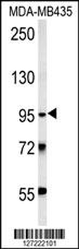 TRHDE Antibody (C-term)