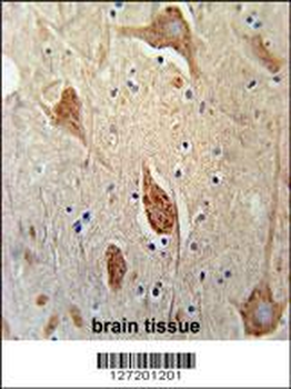FGFBP3 Antibody (C-term)