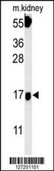 FGFBP3 Antibody (C-term)