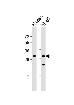 FGFBP3 Antibody (C-term)