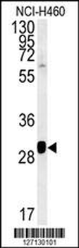 SC31B Antibody (C-term)