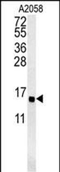 GOT1A Antibody (C-term)