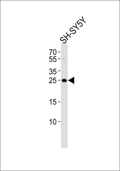 REG3G Antibody (Center)