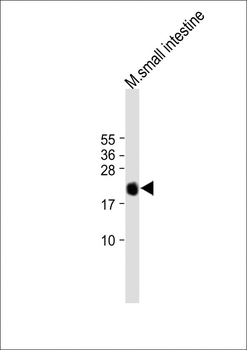 REG3G Antibody (Center)