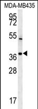 TNIP3 Antibody (N-term)