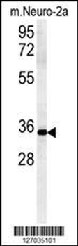 ZDHC2 Antibody (N-term)
