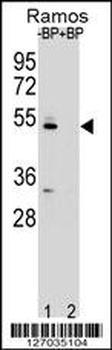 ZDHC2 Antibody (N-term)