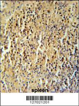 CC106 Antibody (Center)