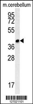 CC106 Antibody (Center)
