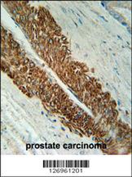 STEA2 Antibody (Center)