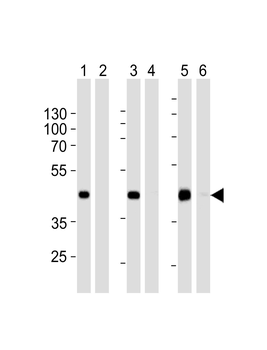 STEA2 Antibody (Center)