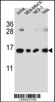 H2AFJ Antibody (N-term)