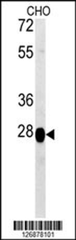 PREPL Antibody (C-term)
