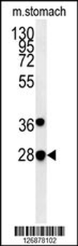 PREPL Antibody (C-term)