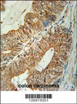 TSPAN3 Antibody (Center)