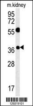 TSPAN3 Antibody (Center)