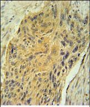 AVP Antibody (Center)