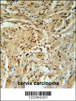 BLOC1S2 Antibody (Center)