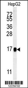 BLOC1S2 Antibody (Center)