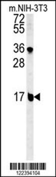 BLOC1S2 Antibody (Center)