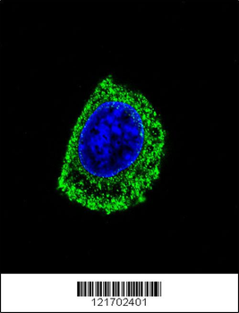 DDC Antibody (N-term)