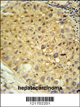 DDC Antibody (N-term)