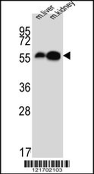 DDC Antibody (N-term)